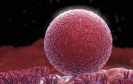 试管婴儿打降调针的作用及注意事项你知道吗？