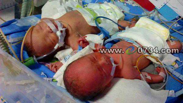 试管双胞胎早产 悲情母亲盼大家拯救弱小生命