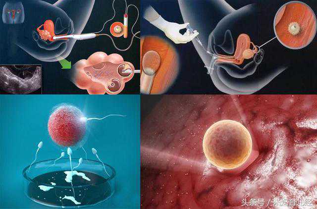 试管婴儿全过程（图解），看哭了，真的心疼天下妈妈10000遍