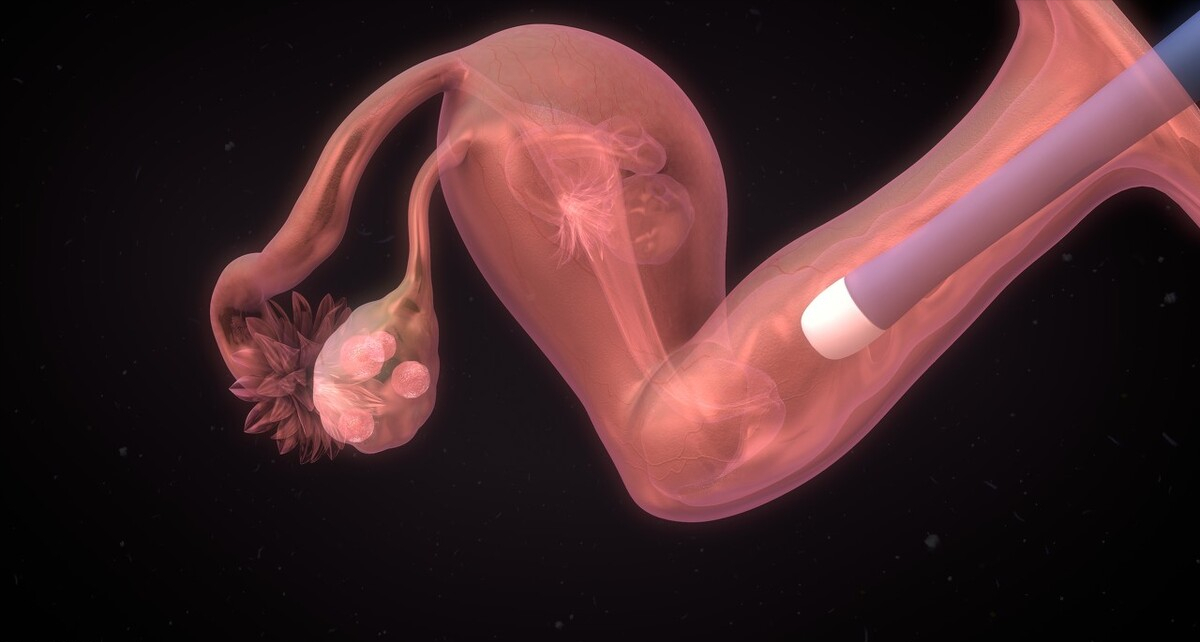 试管婴儿技术生出来的孩子到底健康不健康？能解决女性的焦虑吗？