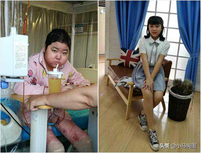 试管女孩抗血癌8年等来重生 出院后却两眼一黑跪倒在父母面前