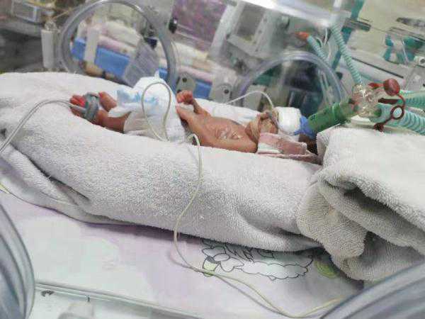 6年艰辛求子，试管龙凤胎宝宝却27周早产……