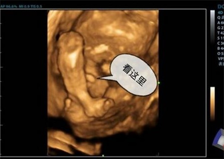 孕期的这些“胎梦”可能预示着宝宝的性别，你有中招了吗？